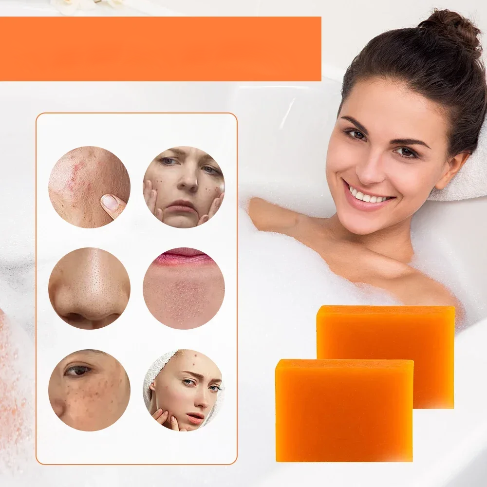 kynovate Handmade Antibacterial soap Natural Mild Non-irritating Brightening Skin Exfoliator Body Face Cleansing Whitening Soap