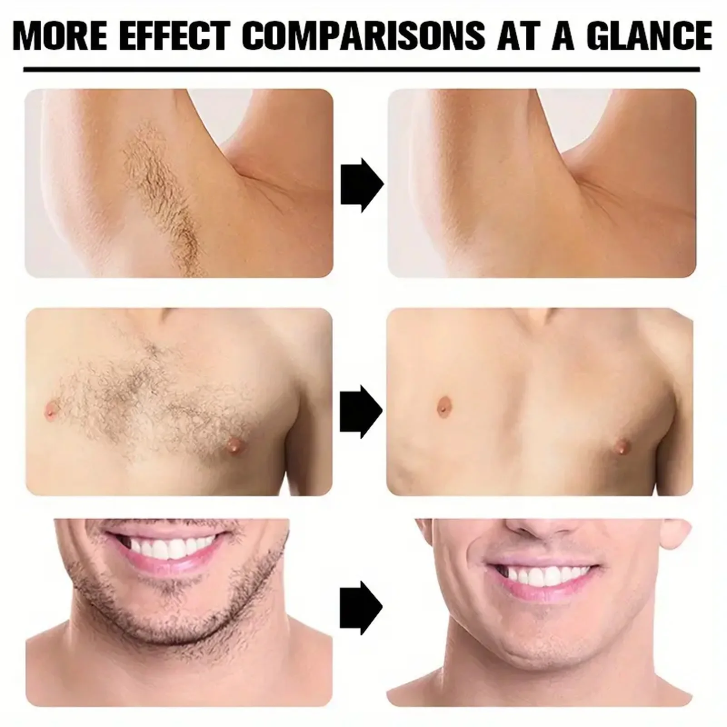 win ouo Hair Removal Cream Permanent Epilator Cream Intimate Areas Health Painless Hair Remover Growth Inhibitor for Woman Men Body Care Depilatory creams